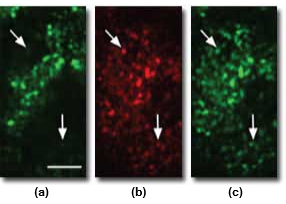 confocalaberrations_Figure3.png