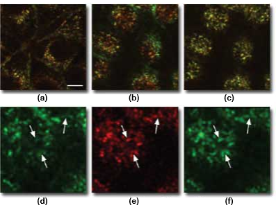 confocalaberrations_Figure6.png